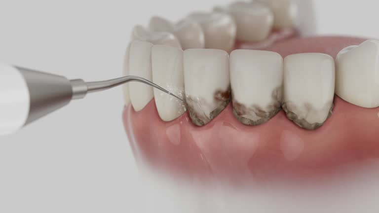 Trusted Wisdom Tooth Removal service in Pleasant Garden, NC - Dentist Open Now